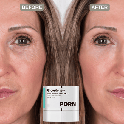 GlowRenew™ Instant Hydra Stick