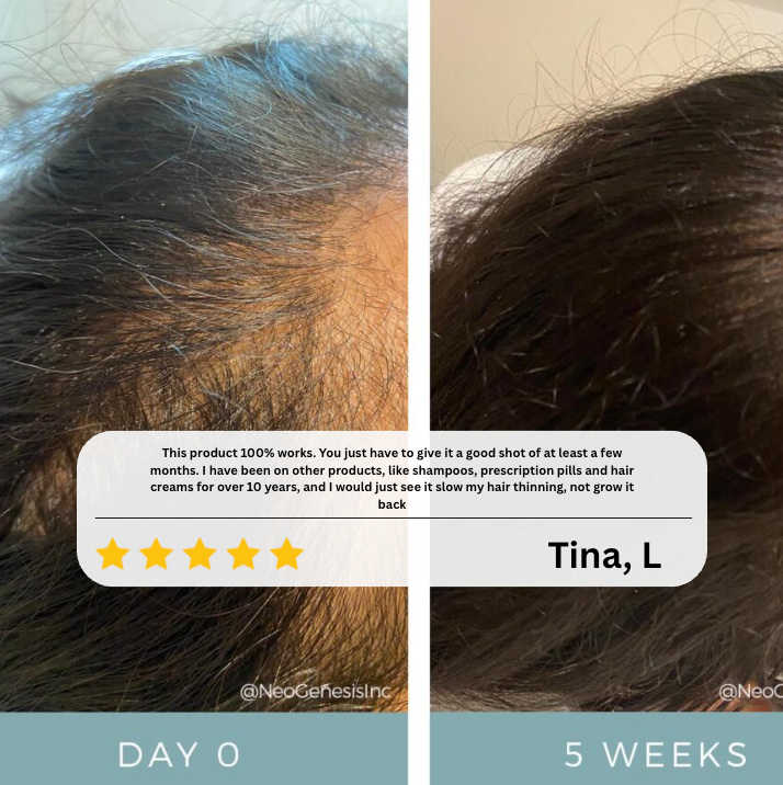 ReGrow+™ Hair Growth Serum Roll-On