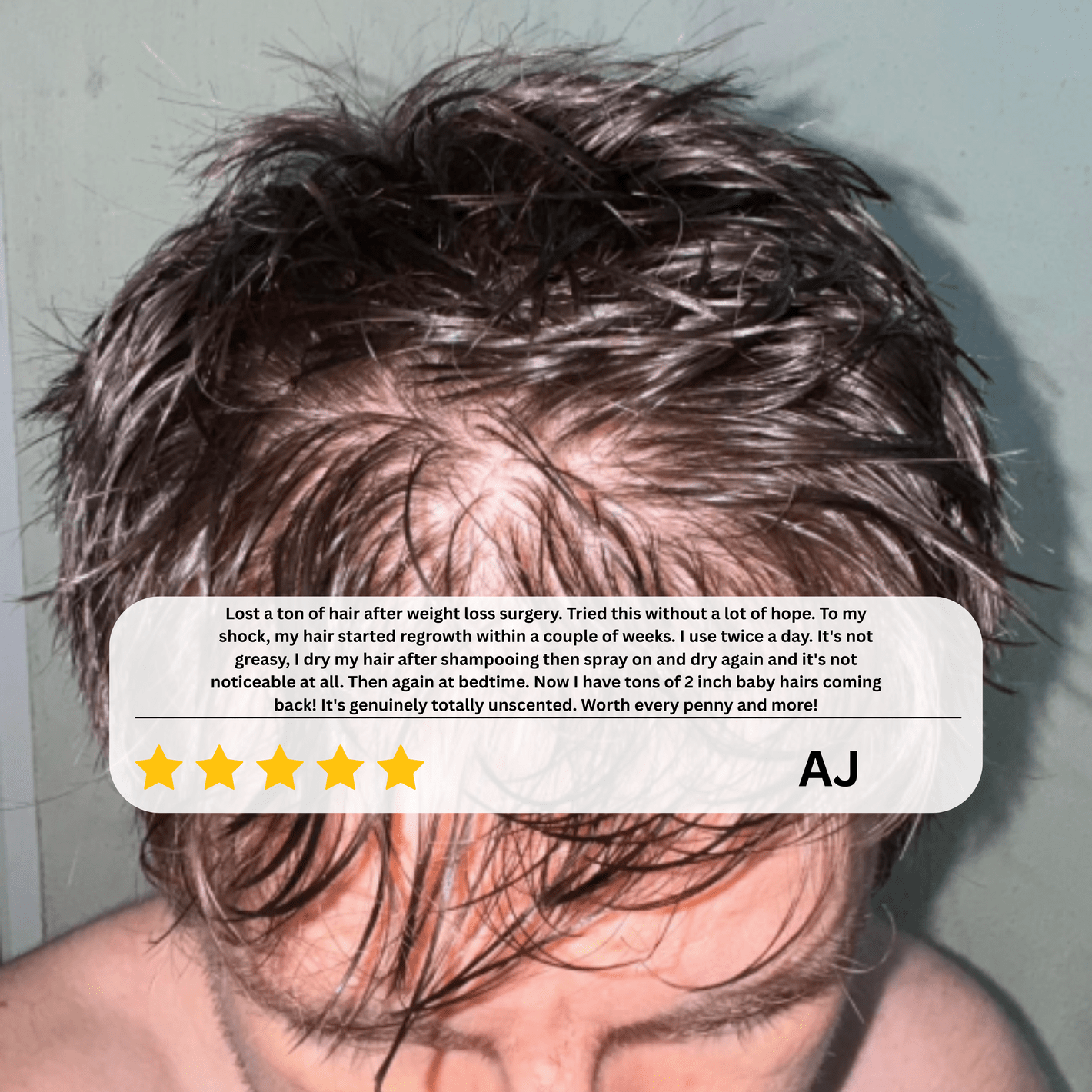 ReGrow+™ Hair Growth Serum Roll-On